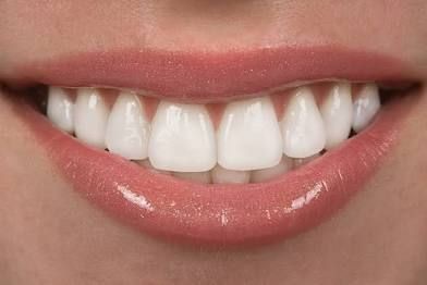 Try-Me Teeth Whitening 