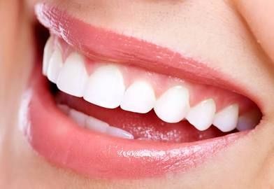 Essential Teeth Whitening    